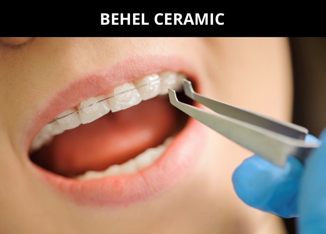 Behel Ceramic